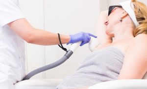 laser hair removal treatment